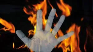 सांताक्रूज़ में वीडियो कॉल के दौरान 19 वर्षीय एक युवक ने खुद को आग लगाई...