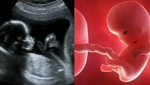 बीड़ जिले में भ्रूण लिंग जांच गिरोह का पर्दाफाश... सोनोग्राफी मशीन और गर्भपात की गोलियां जब्त, दो गिरफ्तार