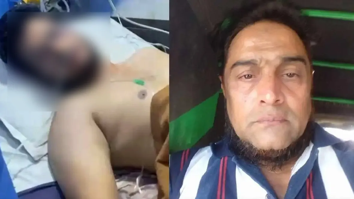 ठाणे: हनीमून के लोकेशन को लेकर हुई भयंकर लड़ाई, गुस्साए ससुर ने दामाद पर फेंका तेजाब