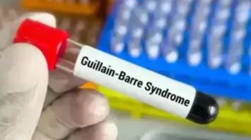 पुणे में जीबीएस के कारण दो और मौतों की सूचना