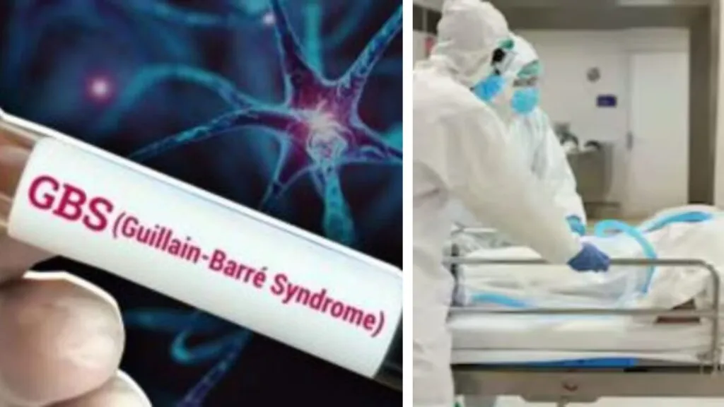 पुणे : जीबीएस के संदिग्ध मामलों की कुल संख्या बढ़कर 166