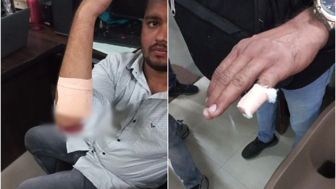 ठाणे : ट्रेन में तीन लोगों पर चाकू से हमला; 19 वर्षीय युवक गिरफ्तार