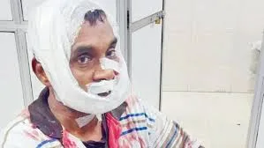 मुंबई : दो अज्ञात हमलावरों ने 52 वर्षीय  व्यक्ति पर हमला कर गंभीर रूप से कर दिया घायल 