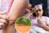मुंबई : मच्छर जनित बीमारियों का खतरा; डेंगू और मलेरिया के मामलों में वृद्धि दर्ज