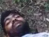ठाणे में 27 वर्षीय युवक के साथ जंगल में क्रूरता...  पूर्व सभापति ने तलवार से दोनों हाथ काटे