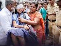 महाराष्ट्र : अहिल्यानगर में छठी की छात्रा पर एसिड अटैक...  चेहरा-आंखें बुरी तरह झुलसी