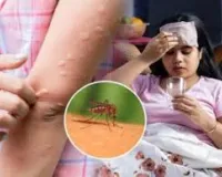 मुंबई : मच्छर जनित बीमारियों का खतरा; डेंगू और मलेरिया के मामलों में वृद्धि दर्ज