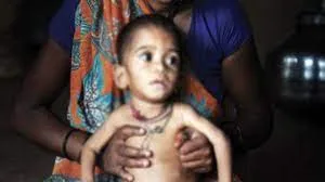 ठाणे में 1,000 से अधिक बच्चे कुपोषण का शिकार, जिले में 'कुपोषण मुक्तिसाथी दत्तक-पालक अभियान' की हुई शुरुआत
