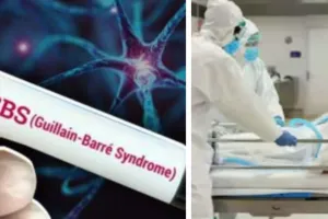 पुणे : जीबीएस के संदिग्ध मामलों की कुल संख्या बढ़कर 166