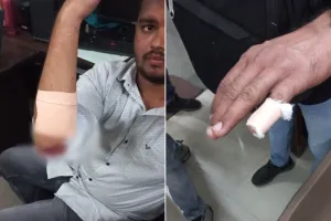 ठाणे : ट्रेन में तीन लोगों पर चाकू से हमला; 19 वर्षीय युवक गिरफ्तार